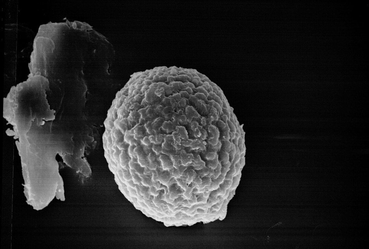 Electron microscope view of one round, rough-surfaced resting spore (teliospore) of Tilletia indica, the fungus that causes Karnal bunt of wheat